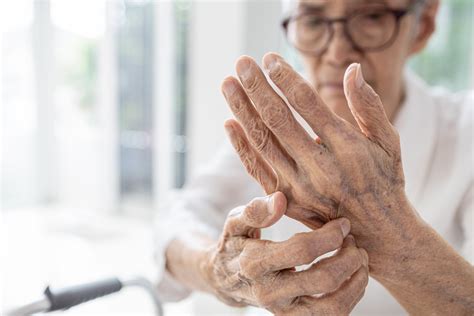 5 Common Skin Conditions in the Elderly – Cottonique - Allergy-free Apparel