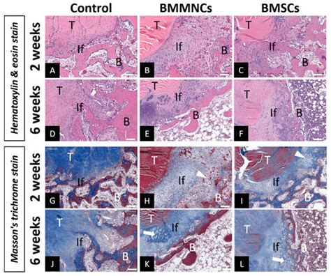 Effect of Freshly Isolated Bone Marrow Mononuclear Cells and Cultured ...