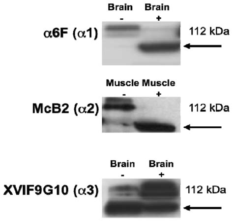 IJMS | Special Issue : Membrane Transport