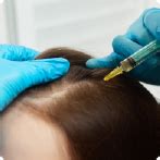 Receding Hairline: Causes, Symptoms, Stages and Treatment