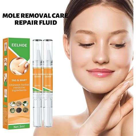 Mole Removal Cream