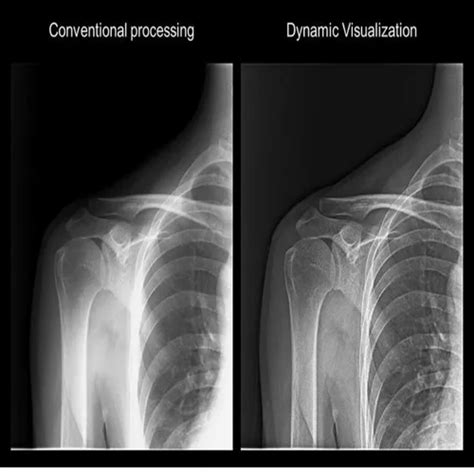 Portable X Ray Machine - Portable X Ray Machines Trader - Wholesaler ...