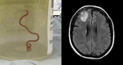 Image result for Memory Worm