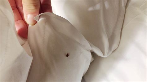 Tratamiento Para Las Picaduras De Chinches Cómo Eliminar Las Chinches