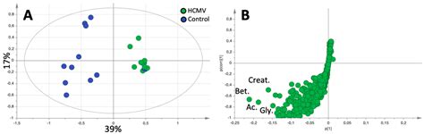 1H-NMR Urinary Metabolic Profile, A Promising Tool for the Management ...