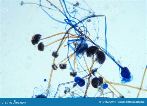 Rhizopus Microscope Rhizopus Nigricans In Microscopy Stock Photo