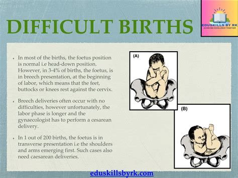 Image result for Parturition Class 12