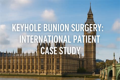 From Saudi Arabia to London: A Patient’s Journey with Keyhole Bunion Surgery - Bunion Surgeon London