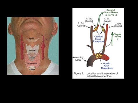 Animation Cardiac Output 的图像结果