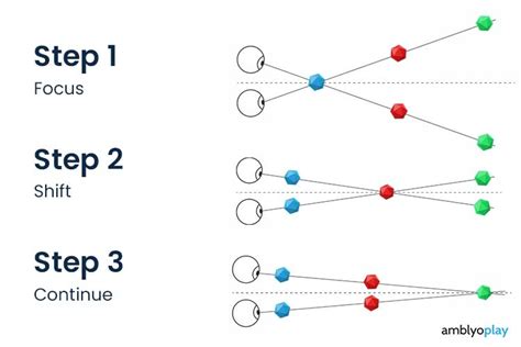 Image result for Brock String Exercise with One Bead