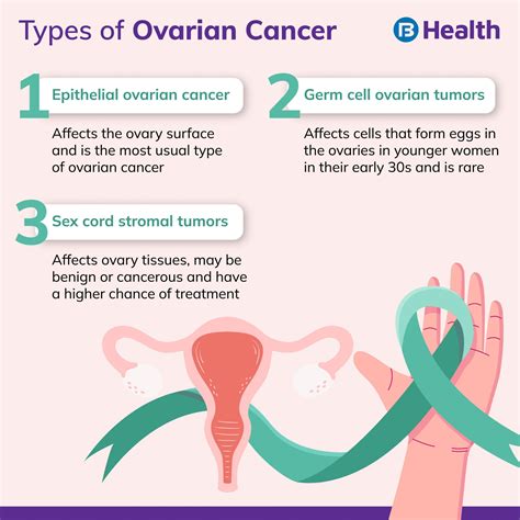 Ovarian cancer – Artofit