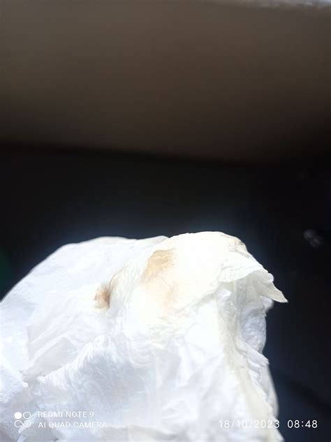 Help jelly like discharge | BabyCenter