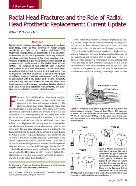 Prosthetic Radial Head 的图像结果