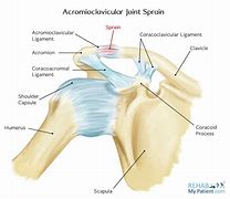 Image result for Acromioclavicular