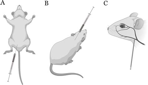 Image result for Intraperitoneal Injection in Humans