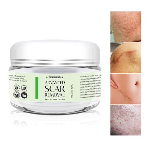 The 7 Best Scar Creams of 2020