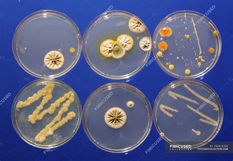 Microbiological cultures growing in Petri dishes. — growth, analysis ...