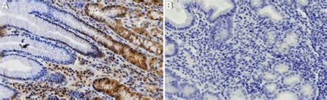 Anti-Estrogen Receptor α Antibody | 06-935