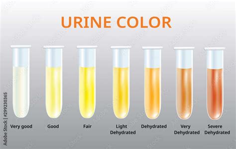 Urine Smells Smoky? 7 Amazing Causes With Remedies