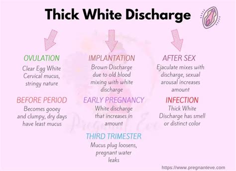 Thick White Discharge: Types, Causes & Treatment