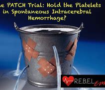 Image result for hold trial