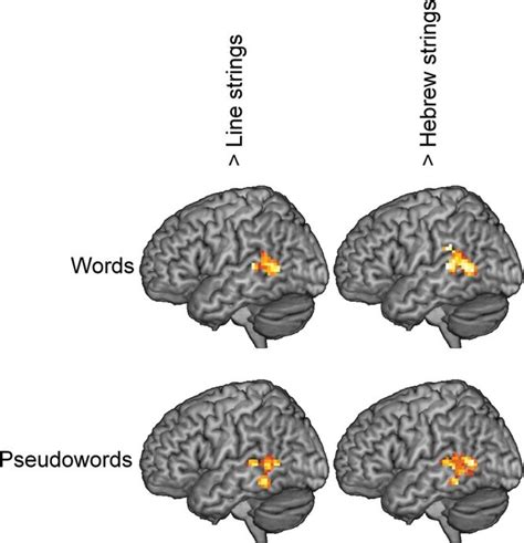 Image result for Types of Stimulus