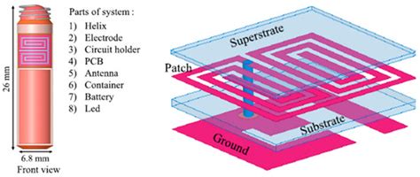 A Comprehensive Review of In-Body Biomedical Antennas: Design ...