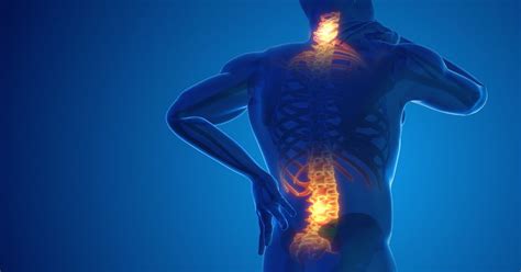 Image result for Back Pain Problem