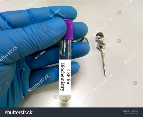 Image result for CSF Sample