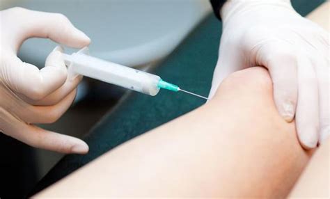 Platelet Rich Plasma Therapy in Chennai | DR. RAJ KANNA
