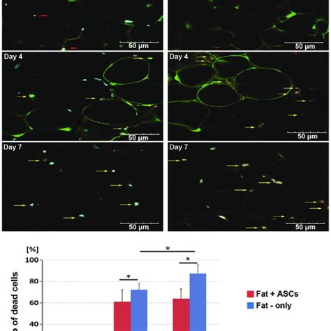 Image result for Deep Tissue Pi