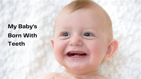 My Baby's Born With Teeth. Should I Worry? | Rodeo Dental