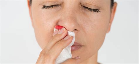 Nose Bleeding in Adults - Prof. Dr. Gediz Murat Serin