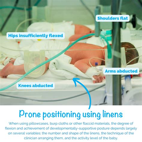 Consistency Is Key: Neonatal Positioning For Neurodevelopmental Support - Dandle•LION Medical