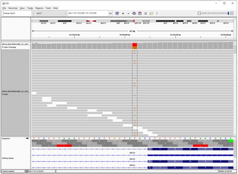Identification of a Splice Variant (c.5074+3A>C) of BRCA1 by RNA ...