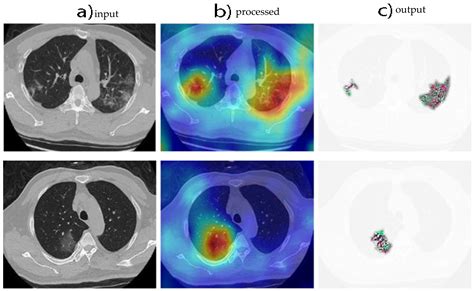 A Deep Learning-Based Framework for Uncertainty Quantification in ...