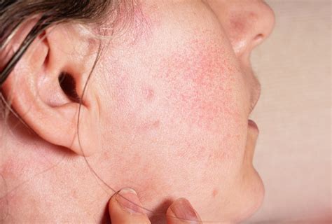 Image result for Different Types of Skin Conditions