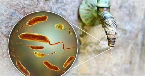 Suspected Typhoid Outbreak in Gandhinagar: Over 100 Hospitalised as ...