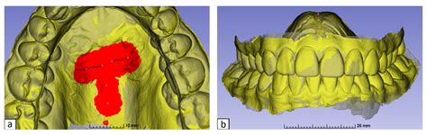 The Role of Stable Anatomical Landmarks in Automated 3D Model ...