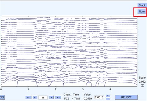 Image result for How to Manually Code in EEGLAB