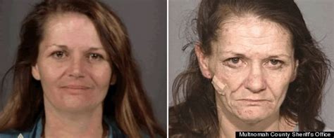 How Face changes by use of Drugs – Ramanisblog