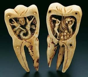 Image result for Medieval Tooth Extraction