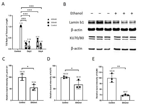 Doxycycline Attenuated Ethanol-Induced Inflammaging in Endothelial Cells: Implications in ...