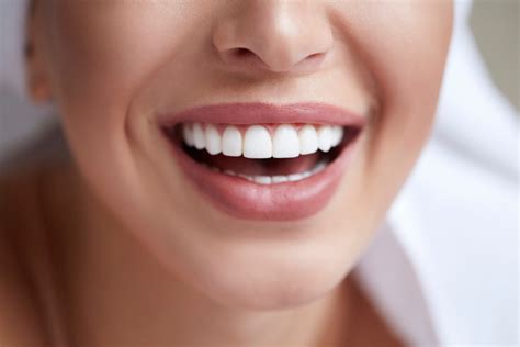 Cost of Veneers for Front Teeth (What You Need to Know) | South Temple ...