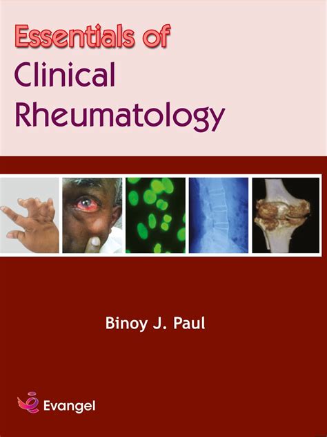 Essentials of Clinical Rheumatology : Binoy J. Paul: Amazon.in: Books