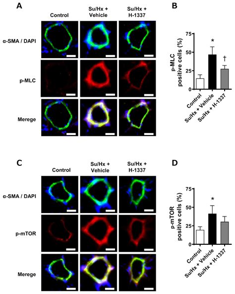 The Isoquinoline-Sulfonamide Compound H-1337 Attenuates SU5416/Hypoxia ...