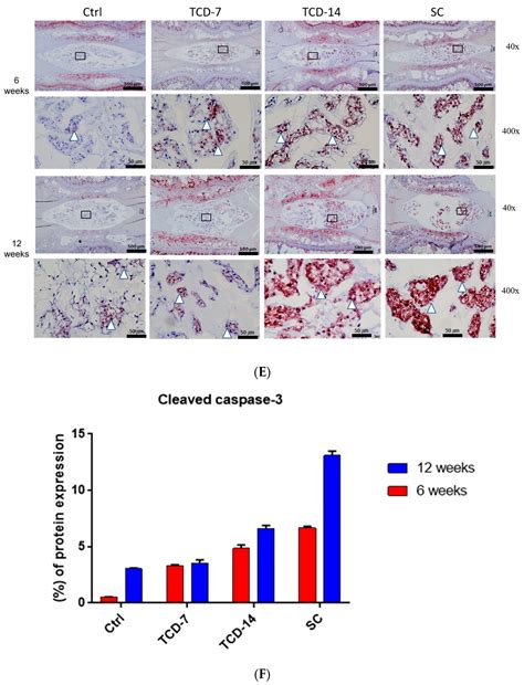 Comparative Analysis of Autophagy and Apoptosis in Disc Degeneration ...