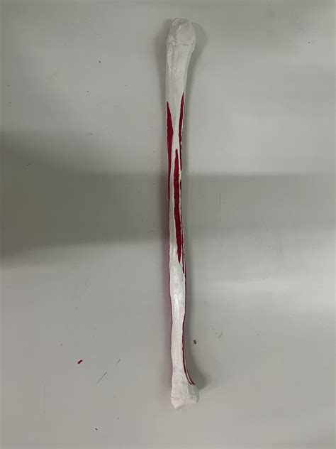 RIGHT FIBULA | NAMO Medical Education & Research Institute