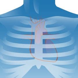 Auscultation | Learn to Listen | Littmann Stethoscopes