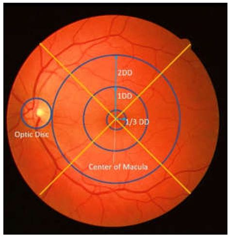 Efficient and Robust Method to Detect the Location of Macular Center Based on Optimal Temporal ...